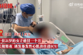 21岁女孩连续熬夜心率失常住进ICU 连续3晚睡眠不足免疫功能低一半